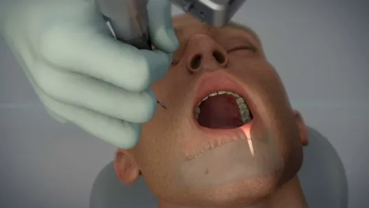 Yomi - The first and only FDA-cleared robotic device for dental surgery thumbnail